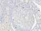 VE-Cadherin Polyclonal Antibody